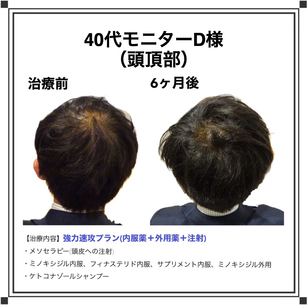 ベアAGAクリニック｜新宿で薄毛治療なら当クリニックがおすすめです