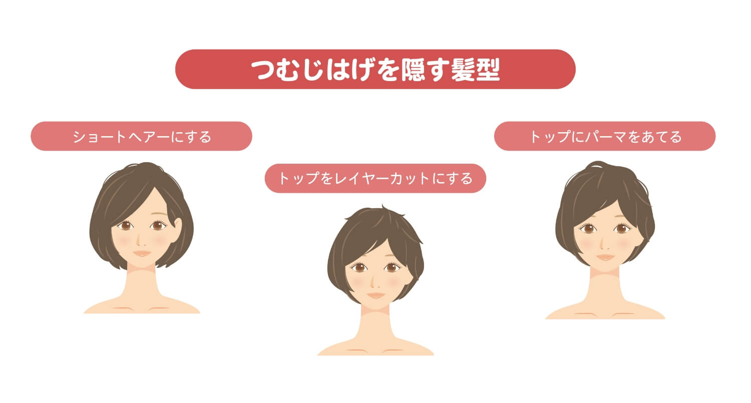 女性のつむじはげは改善する 10代代でも発症する原因や隠し方 改善方法を解説 東京新宿で薄毛治療ならベアagaクリニックへ