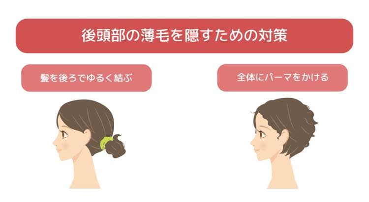 後頭部の薄毛を隠すための対策