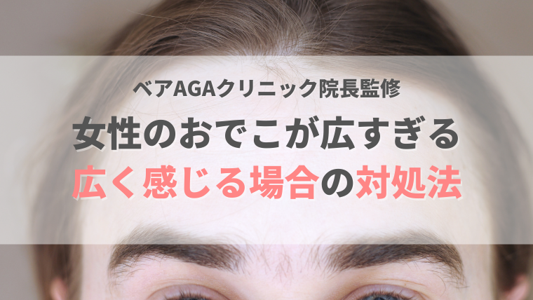 おでこ 広すぎる 女性 アイキャッチ